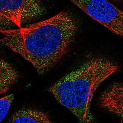 MECR Antibody, Novus Biologicals:Antibodies:Primary Antibodies